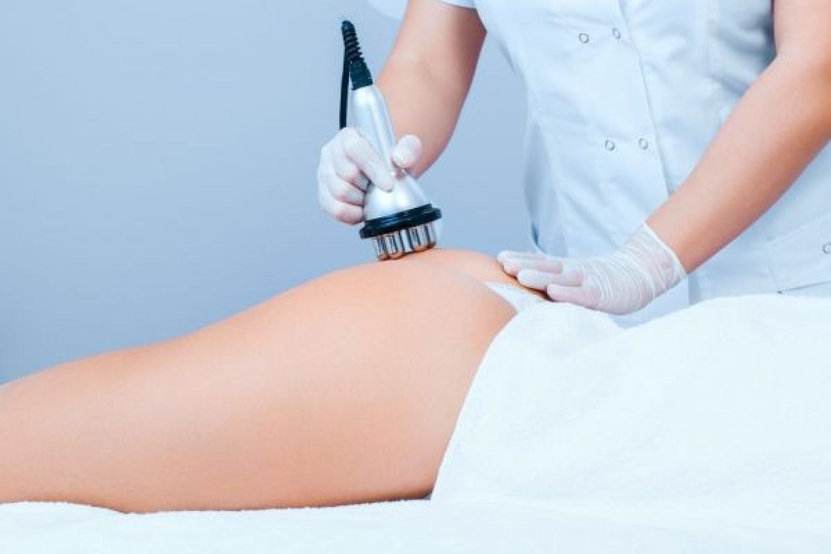 Radio fréquence et Lipocavitation à Ensisheim (68) Par Sandra - Estheca