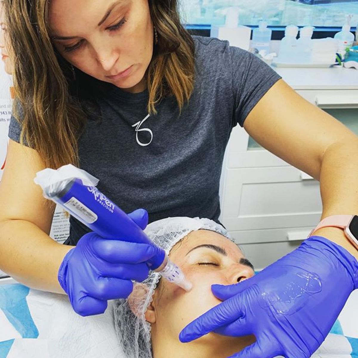 MicroNeedling BB Glow à Échirolles (38) Par Mélissa - Estheca