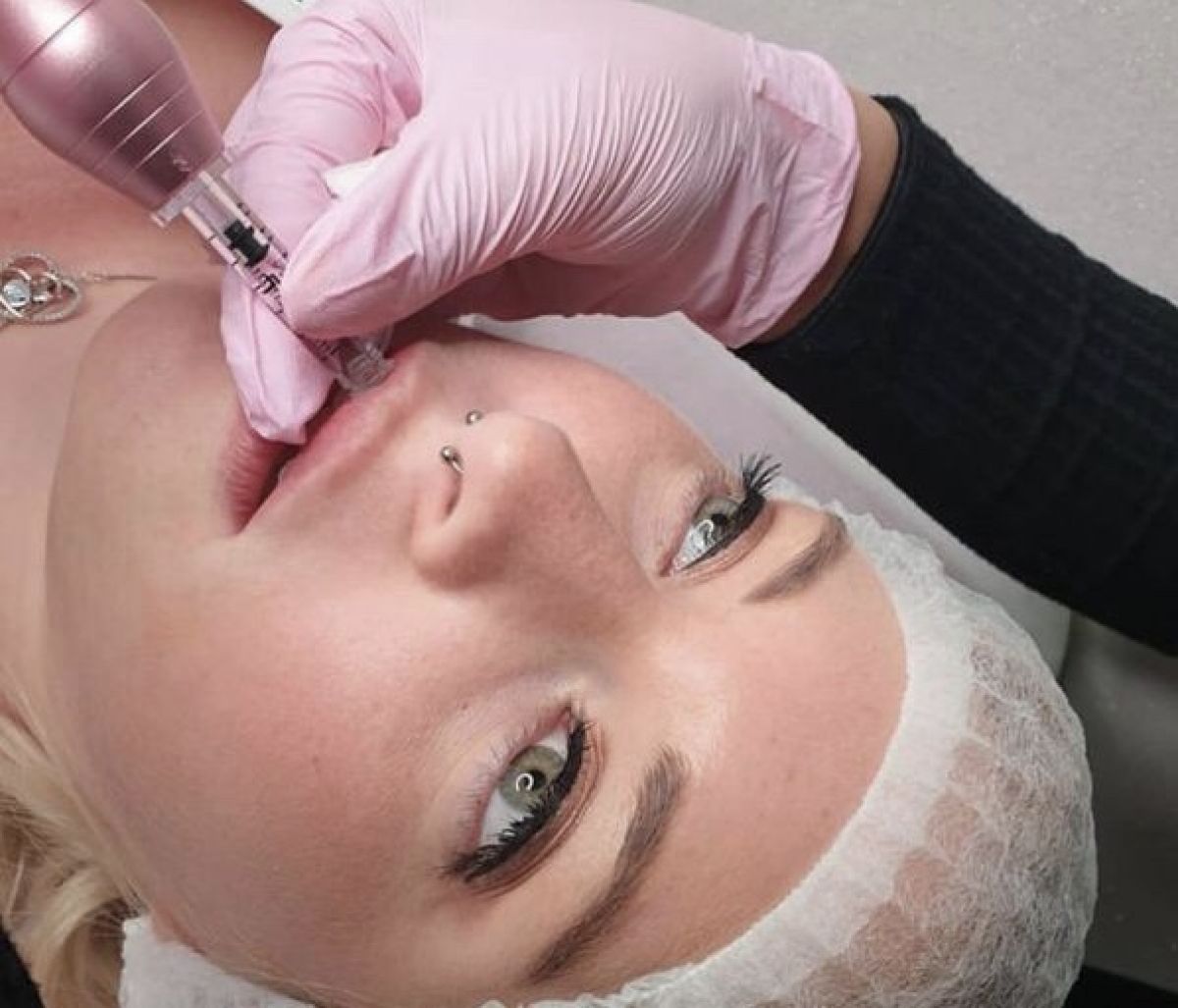 Formation Hyaluron Pen à Lille (59) Par Yasmine - Estheca