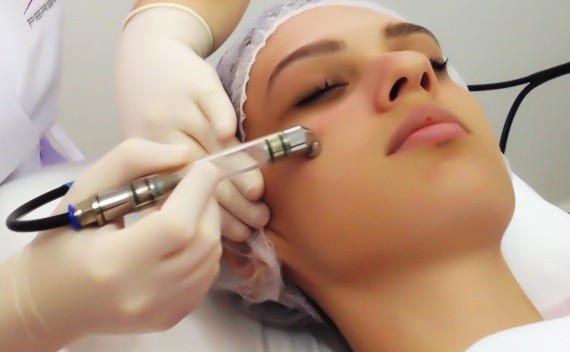 À Tourcoing | Peeling | Les meilleures esthéticiennes