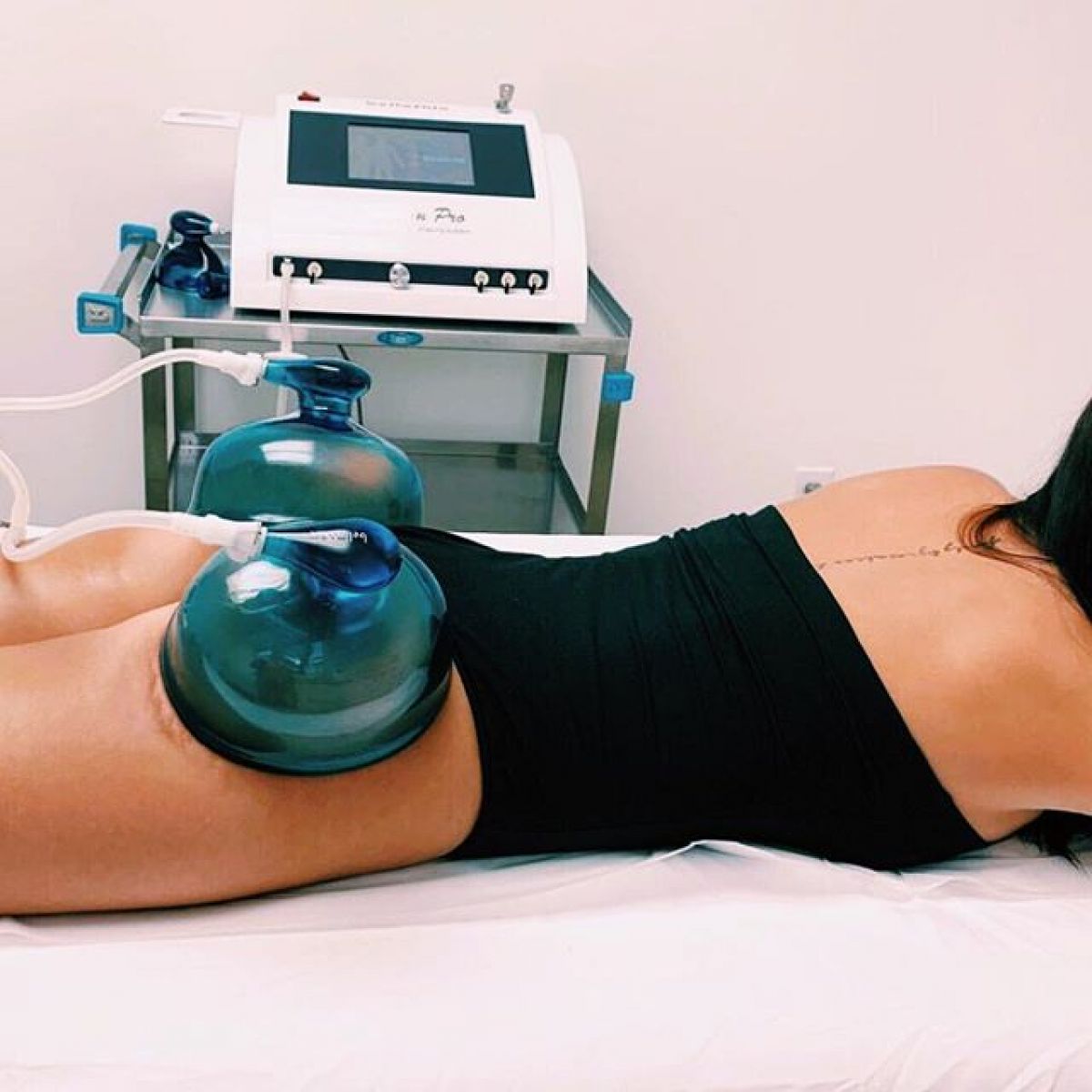 Lifting Colombien à Vandoeuvre-lès-Nancy (54) Par Camille - Estheca