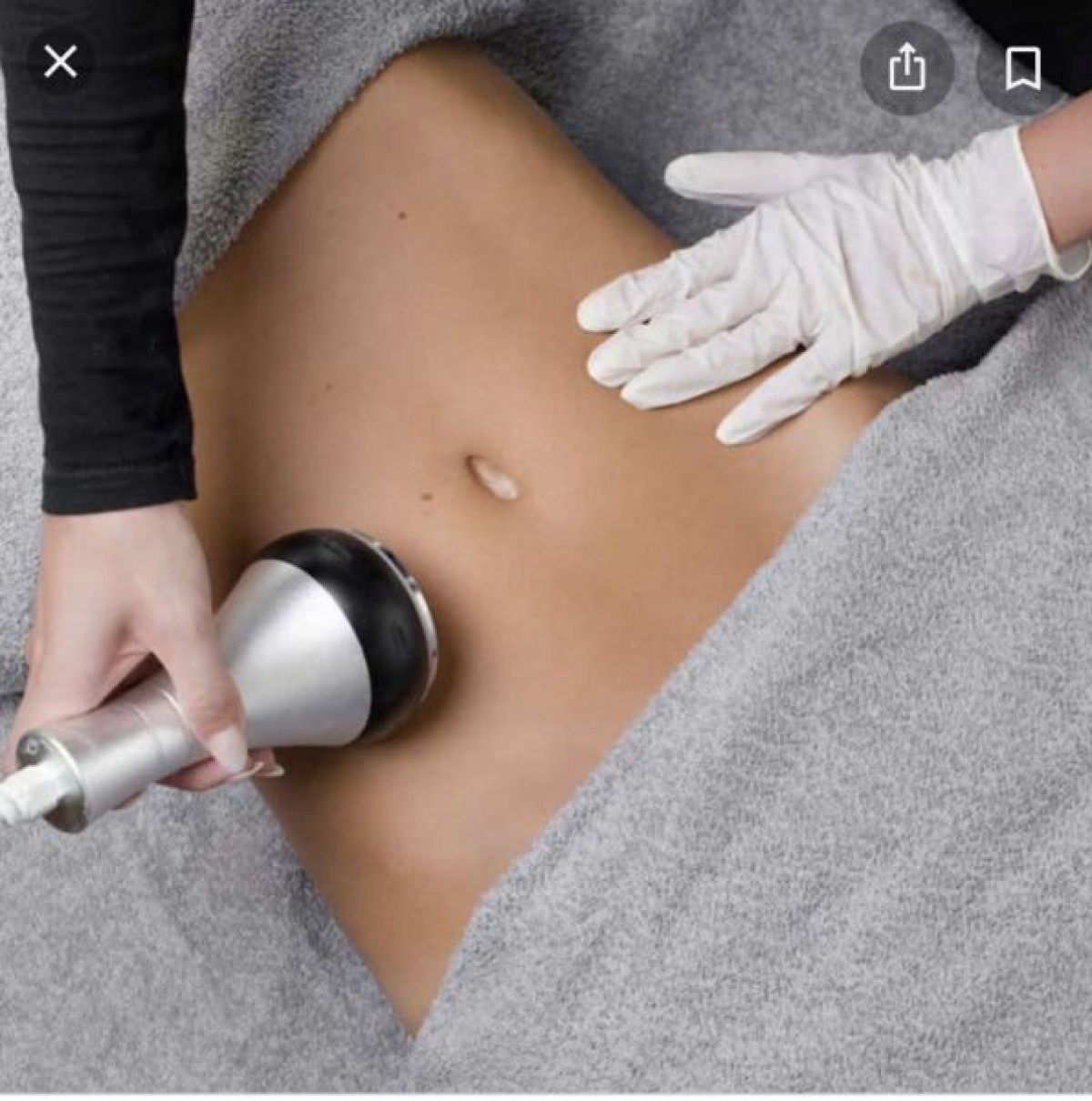 Lipocavitation à Melun (77) Par Jennifer - Estheca