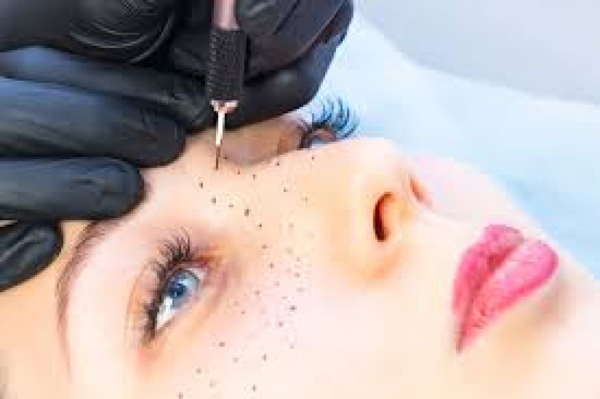 Grain de beauté à Drancy (93) Par Evin - Estheca