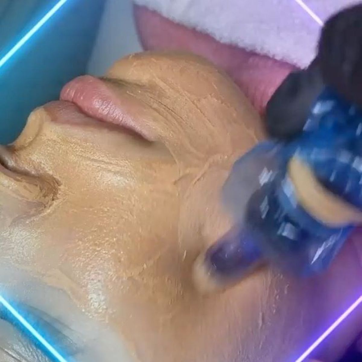 MicroNeedling BB Glow à Villepinte (93) Par Nadège - Estheca
