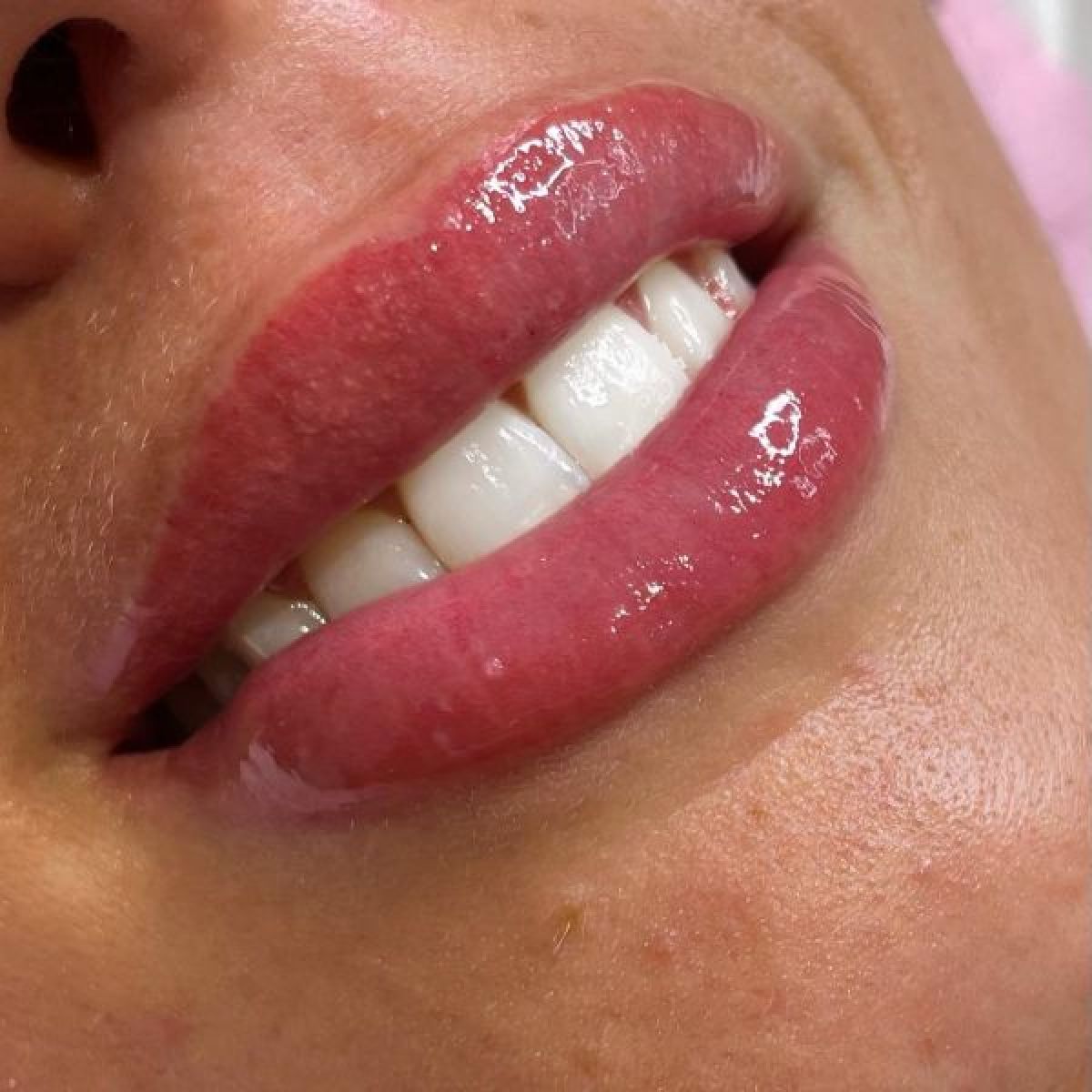 Candy Lips / Maquillage permanent à Douzens (11) Par Alisson - Estheca