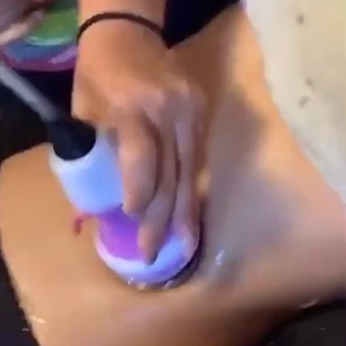 Radio fréquence / Lipocavitation à Villenave-d'Ornon (33) Par Laetitia - Estheca