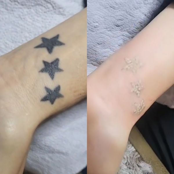 À Le Passage | Detatouage | Les meilleures esthéticiennes