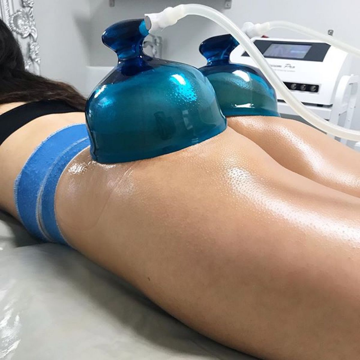 Lifting Colombien à Bordeaux (33) Par Claire - Estheca