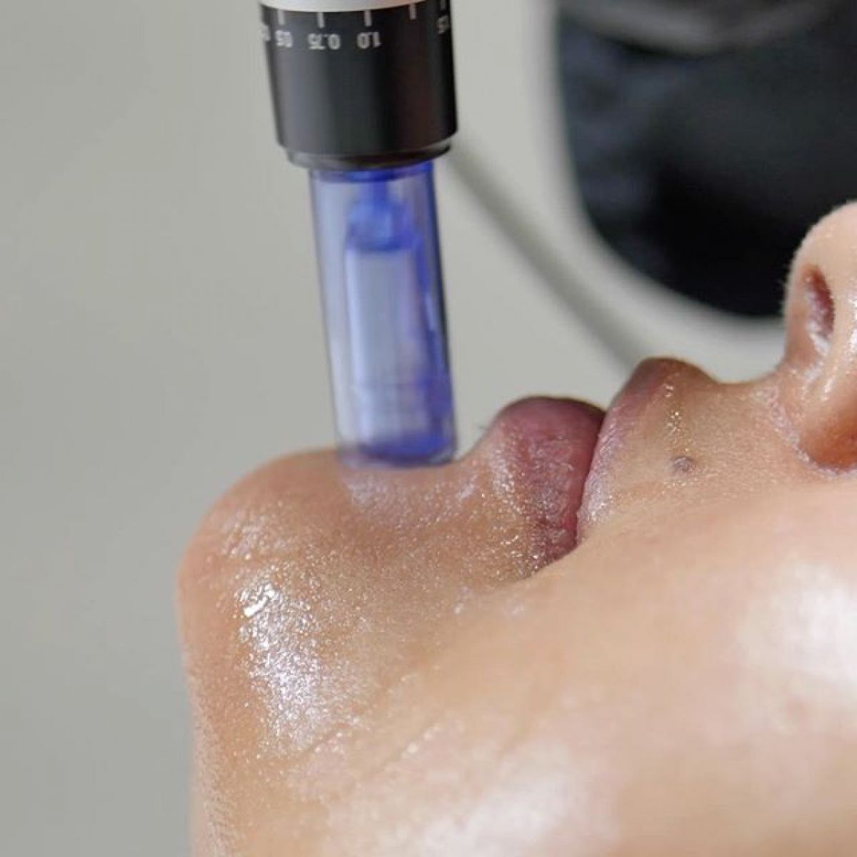 MicroNeedling BB Glow à Laxou (54) Par Pauline - Estheca
