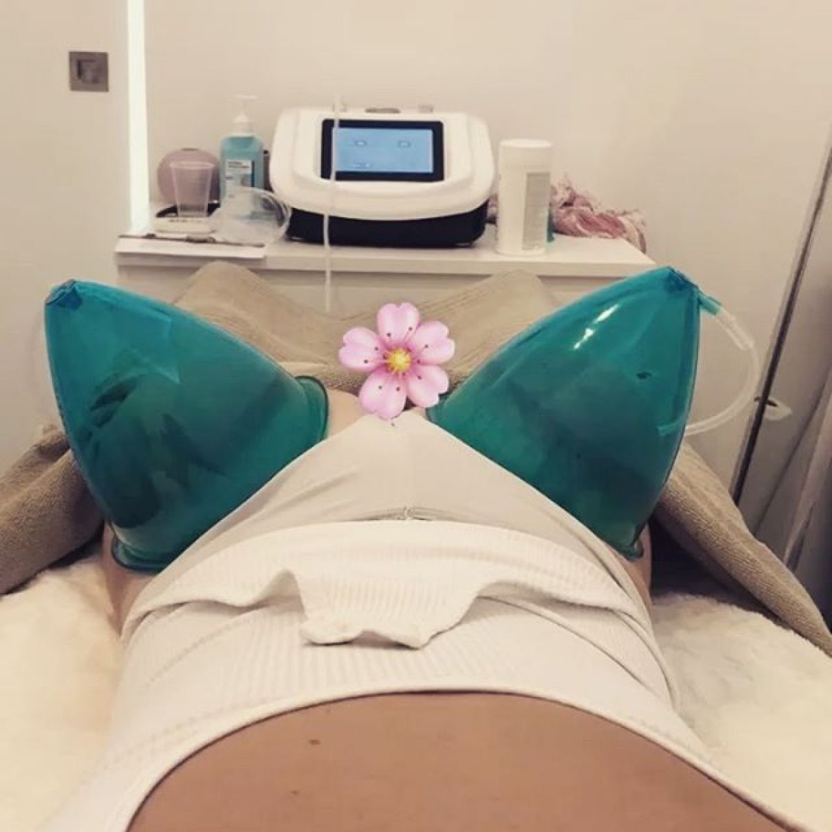 Lifting Colombien à Balma (31) Par Chloé - Estheca