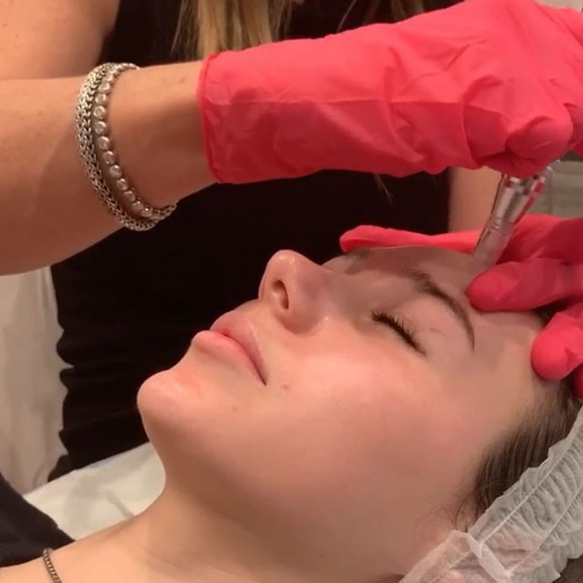 MicroNeedling BB Glow à Alfortville (94) Par Laetitia - Estheca