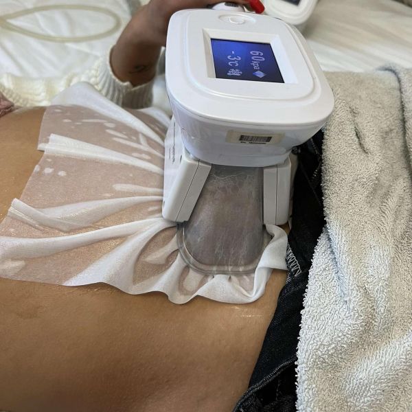 À Aulnay-sous-Bois | Cryolipolise  | Les meilleures esthéticiennes