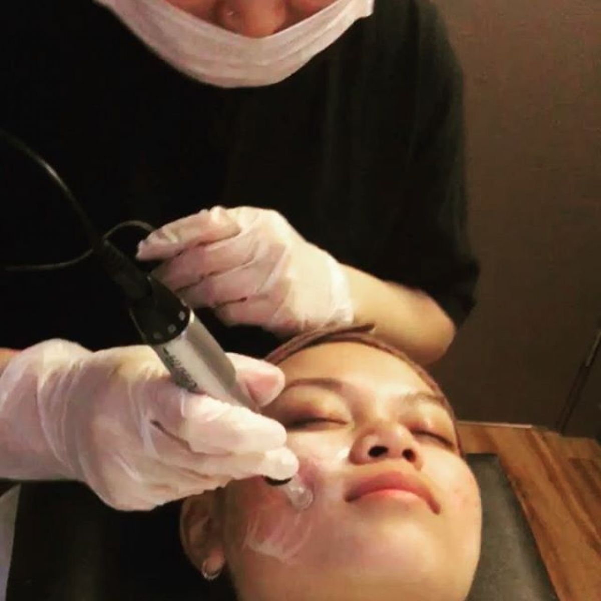 MicroNeedling BB Glow à Bischheim (67) Par Vanessa - Estheca