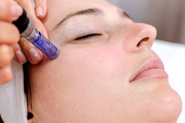 À Tarascon | Nano-needling et Bb skin Glow | Les meilleures esthéticiennes